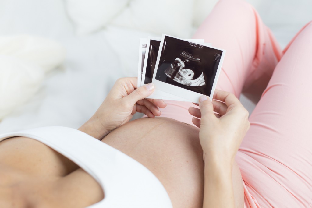 Schwangere Frau liegend betrachtet Ultraschallbilder